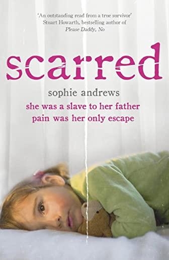 Scarred: She Was a Slave to Her Father. Pain Was Her Only Escape.