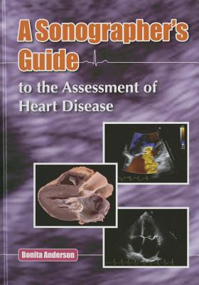 Sonographer's Guide to the Assessment of Heart Disease