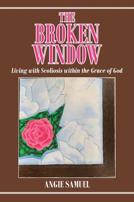 The Broken Window: Living with Scoliosis within the Grace of God