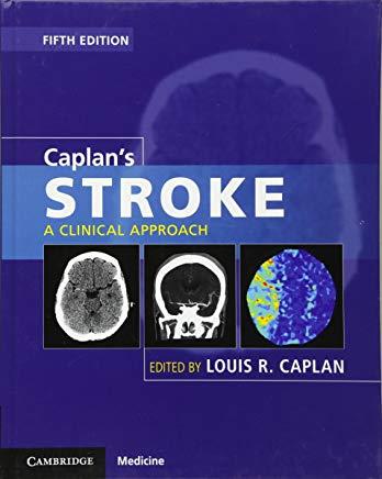 Caplan's Stroke: A Clinical Approach