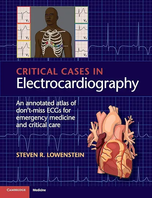 Critical Cases in Electrocardiography: An Annotated Atlas of Don't-Miss Ecgs for Emergency Medicine and Critical Care